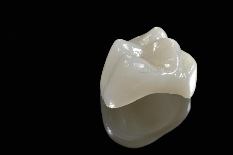 Dental Crowns (Caps)