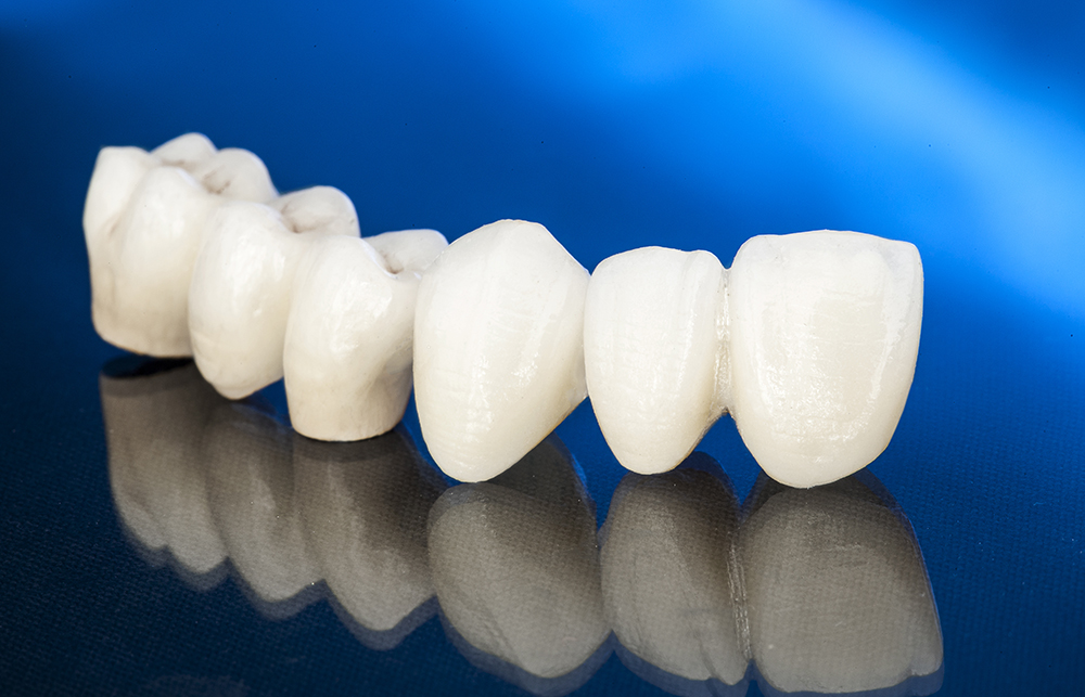Restorative Dentistry